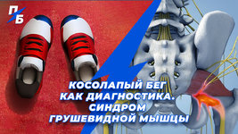 КОСОЛАПЫЙ бег.jpg