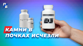 Камни в почках.jpg